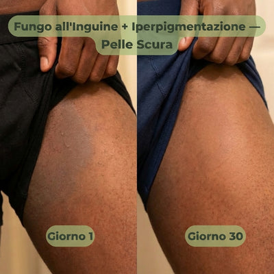 VELORIA SAPONE ANTIFUNGINO