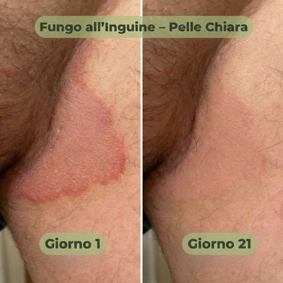 VELORIA SAPONE ANTIFUNGINO