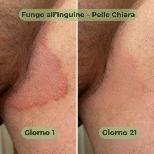 VELORIA SAPONE ANTIFUNGINO