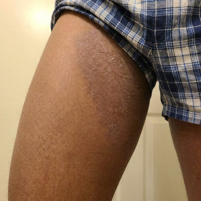 Prima applicazione