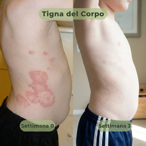 VELORIA SAPONE ANTIFUNGINO